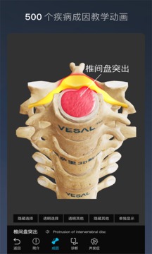 维萨里3D解剖截图