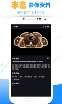 影像學圖譜截圖