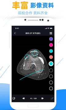 影像學圖譜截圖