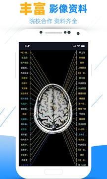 影像解剖圖譜截圖