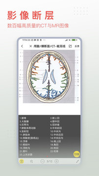 3Dbody解剖截圖
