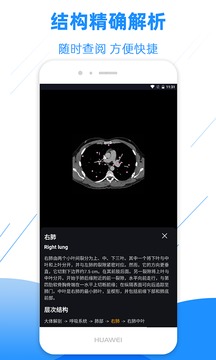 影像解剖圖譜截圖