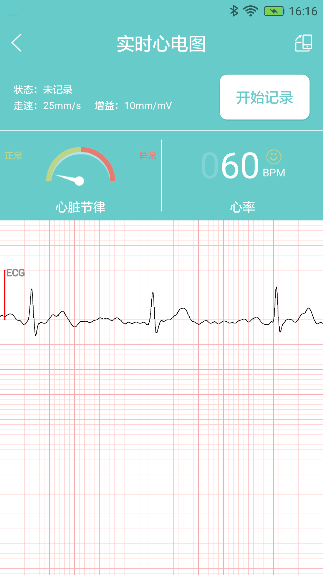 掌上心电截图4