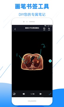 影像解剖圖譜截圖