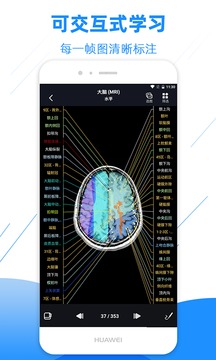 影像解剖圖譜截圖