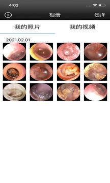 ALK采耳应用截图3