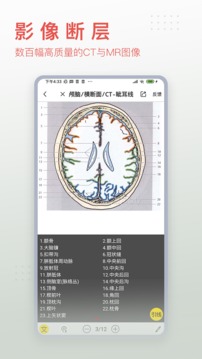 3Dbody解剖截圖