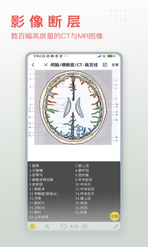 3Dbody解剖截圖