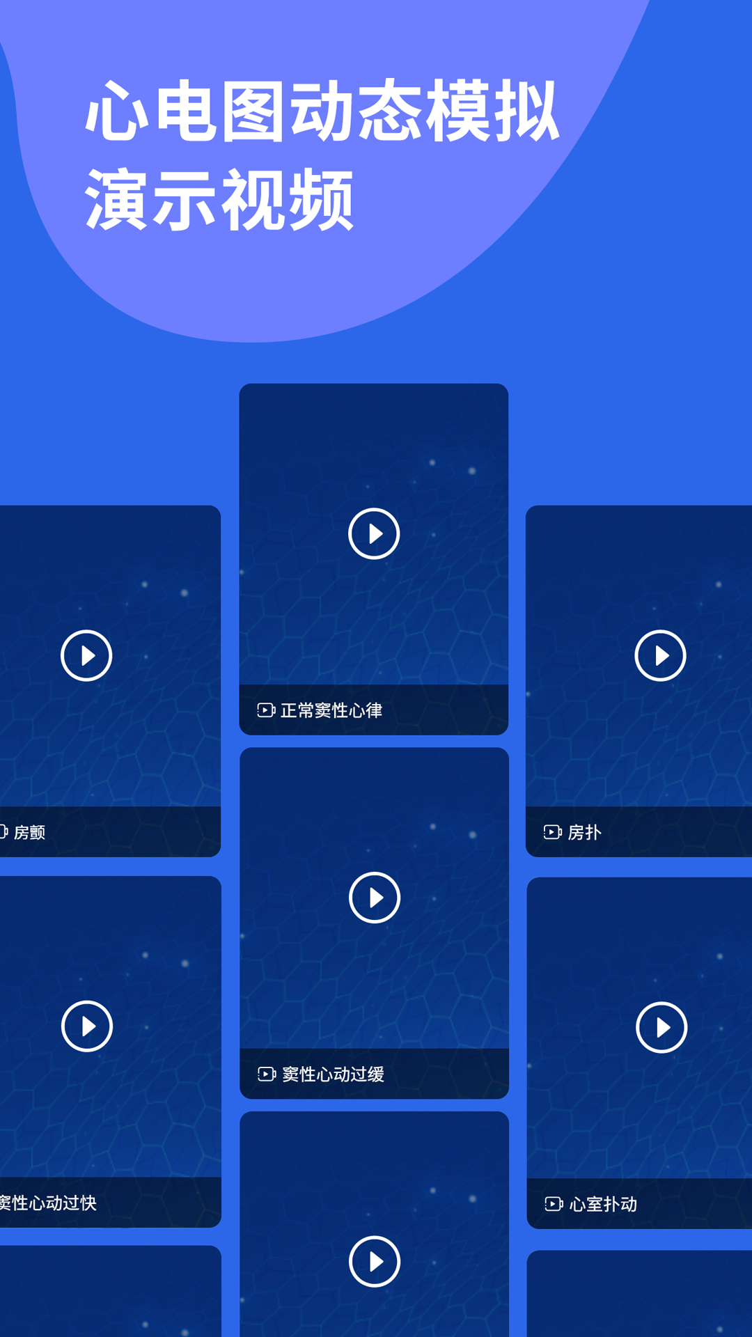 心電圖ECG截圖預(yù)覽