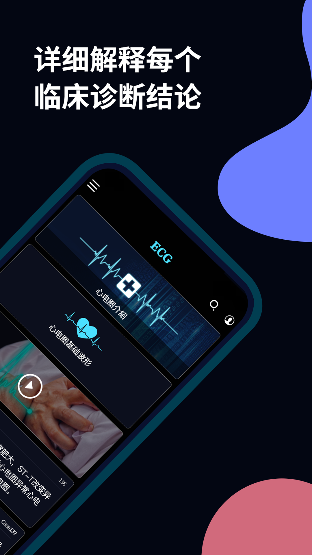 心電圖ECG截圖預(yù)覽