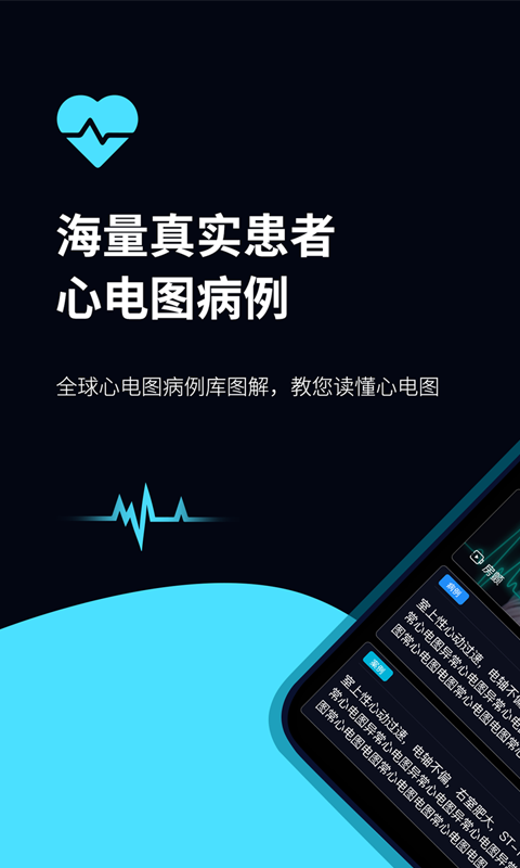 心電圖ECG截圖預(yù)覽