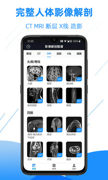 影像解剖圖譜截圖