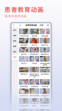 3DBody解剖截圖