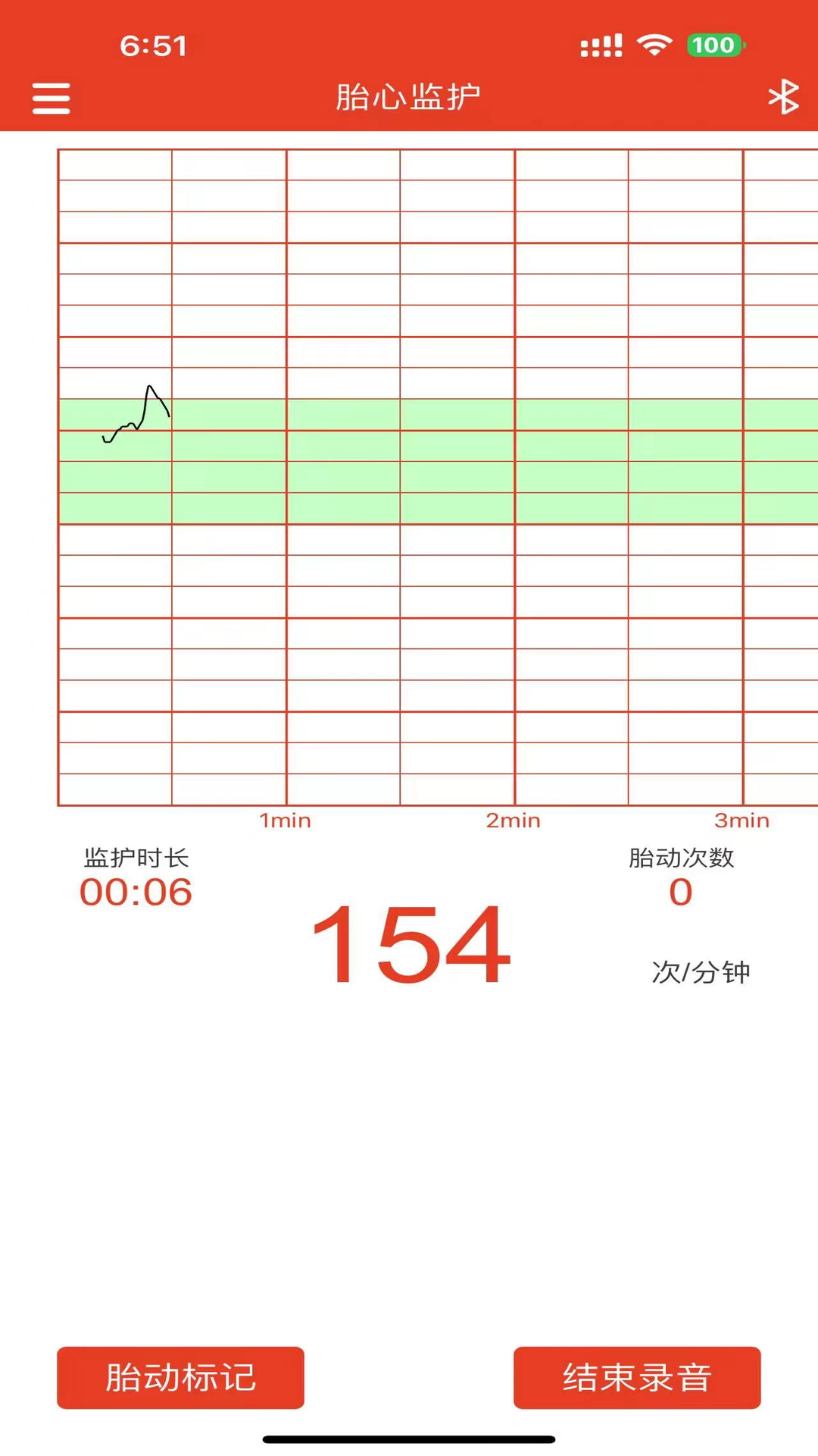 左点胎心仪vV1.1截图3