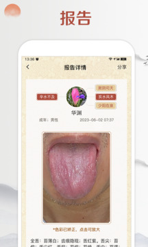 看舌頭截圖