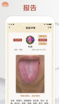 看舌頭截圖