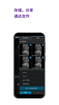 Vscan Air截圖