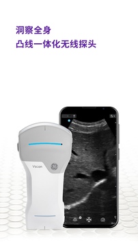 Vscan Air截圖