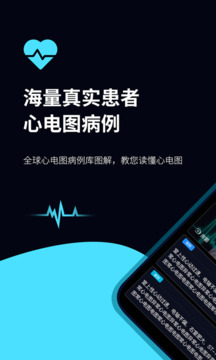 心電圖ECG截圖