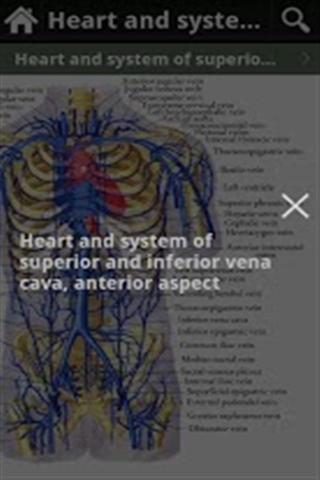 人体解剖图 Anatomy of IOA Lite(高清版)截图5